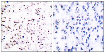 CDC46 antibody