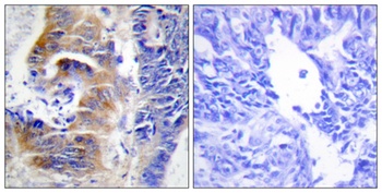 CdcA3 rabbit pAb