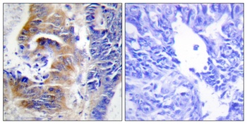 CdcA3 antibody