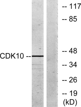 Cdk10 rabbit pAb