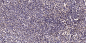Cdk10 rabbit pAb