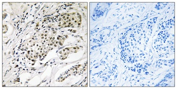 CDYL2 rabbit pAb