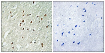 Centrobin antibody