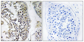 CEP170 antibody