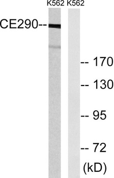 CEP290 antibody