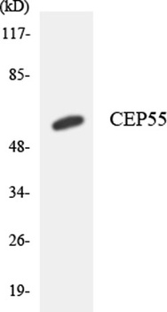 CEP55 antibody