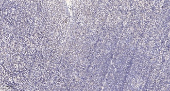 CEP55 antibody