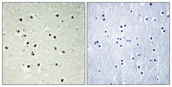 CEP70 antibody