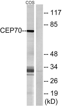 CEP70 rabbit pAb