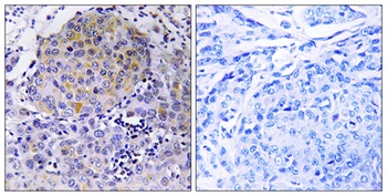 CEP78 antibody