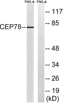 CEP78 antibody