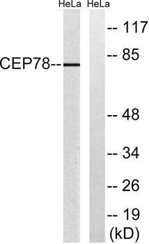 CEP78 rabbit pAb