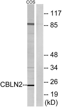Cerebellin 2 rabbit pAb