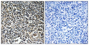 Cerebellin 4 antibody