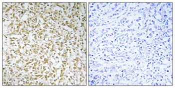 CERKL antibody