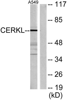 CERKL rabbit pAb