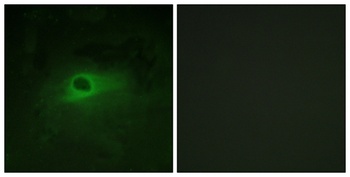 c-Fms antibody