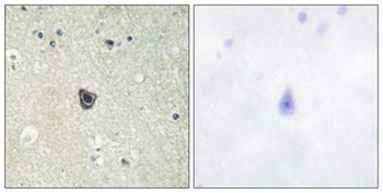 c-Fms antibody