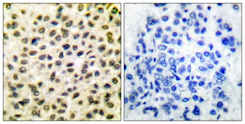 c-Fos antibody