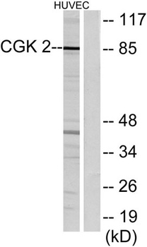 cGKII antibody