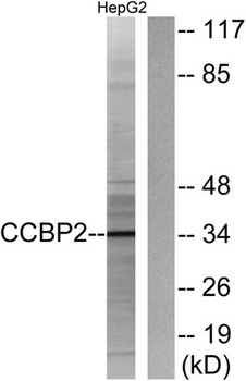 Chemokine Receptor D6 rabbit pAb