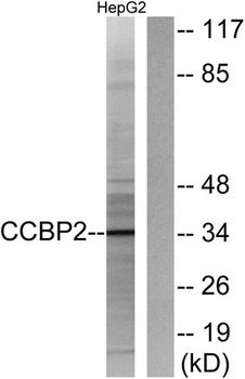 Chemokine Receptor D6 antibody