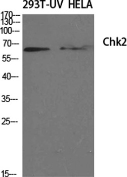 Chk2 antibody
