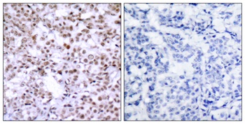 Chk2 antibody