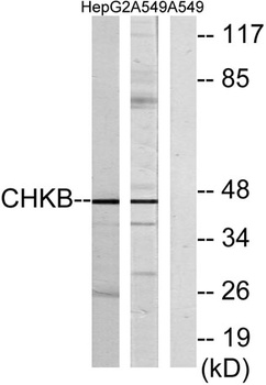 ChoKB rabbit pAb
