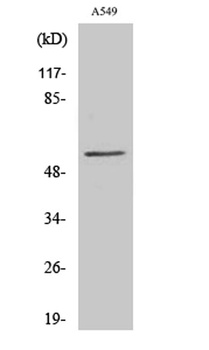 CHST2 antibody