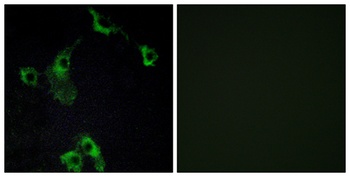 CIDE-B antibody