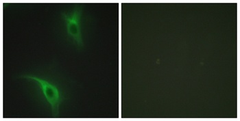 Cks1 antibody