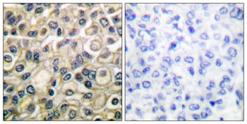 Claudin 1 antibody