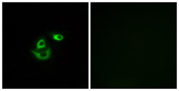 CLCC1 rabbit pAb