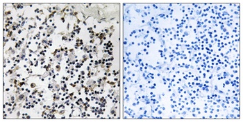 CLIC4 rabbit pAb Antibody