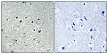 CLK2 antibody