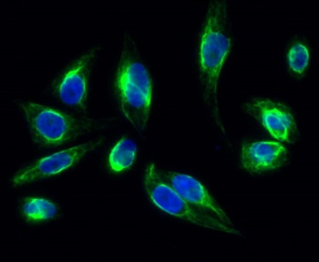 Clusterin rabbit pAb