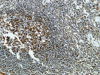 CLU antibody