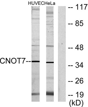 CNOT7 rabbit pAb