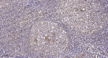 CNOT7 antibody