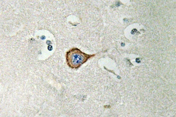 CNPase rabbit pAb