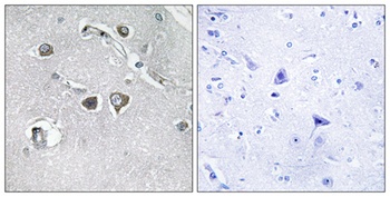 COL11A2 antibody