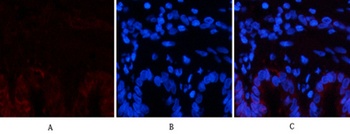 Collagen I antibody