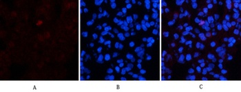 Collagen I antibody