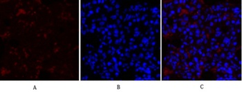 Collagen II antibody