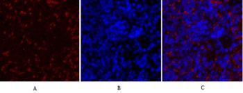 Collagen II antibody