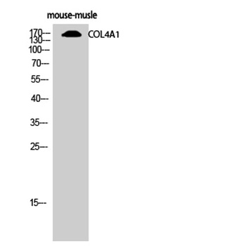 Collagen IV antibody