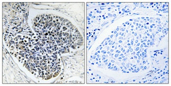 Collagen IV antibody