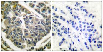 Collagen IV antibody