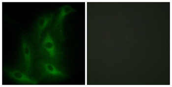 COL4A6 antibody